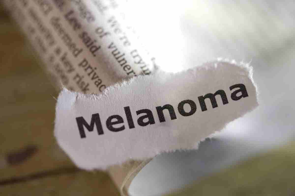 Melanoma come riconoscerlo - Parolibero.it